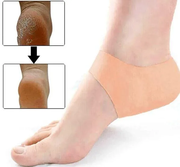Heel Anti-Crack Sets